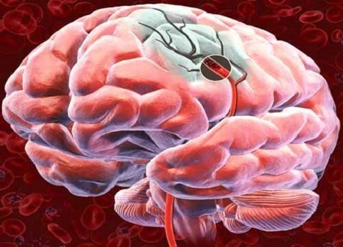 Découvrez 5 manières de tonifier votre flux sanguin cérébral