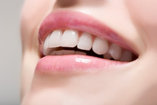 Sourire-parfait-500x335
