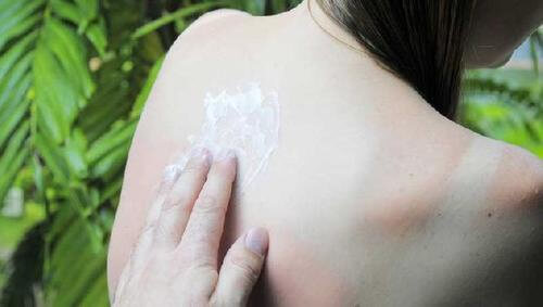 5 conseils pour éviter les coups de soleil et les taches sur la peau