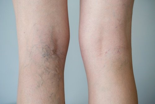 Découvrez les aliments qui favorisent la circulation sanguine dans les jambes