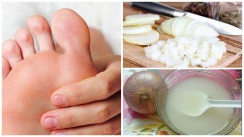 Cors aux pieds : 7 remèdes maison