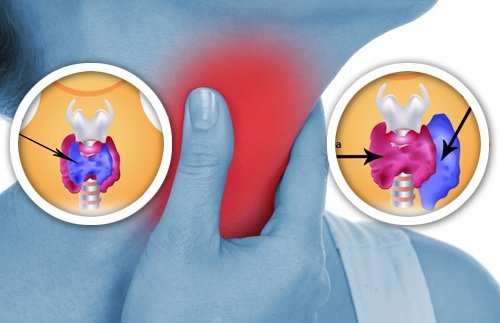 8 produits pour le foyer qui affectent la thyroïde