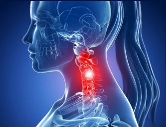 Spondylose cervicale : symptômes et traitements