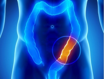 Plus de 90% des maladies sont liées à un côlon sale. Apprenez à le nettoyer !