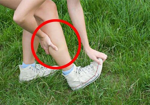 Le gonflement des jambes.