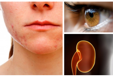 Quels sont les organes endommagés lorsque l'on souffre de stress ?