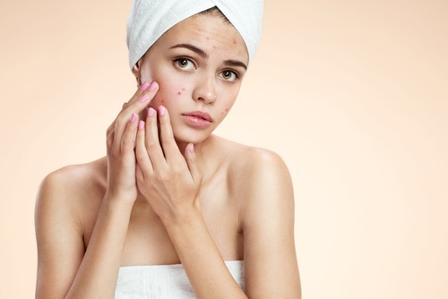 Lutter-contre-l'acne-500x334