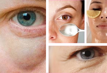 Des astuces simples pour combattre les poches sous les yeux