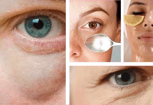 Des astuces simples pour combattre les poches sous les yeux