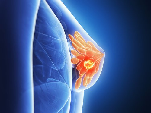 7 mythes et réalités sur le cancer du sein