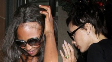 5 conseils pour dissimuler le manque de cheveux