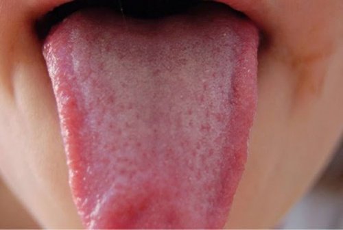 Remèdes naturels pour désinfecter la langue