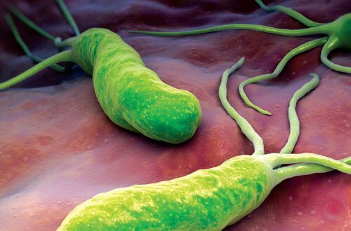 Traitements naturels contre la bactérie Helicobacter