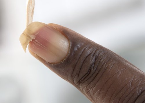 Comment renforcer les ongles cassants ?