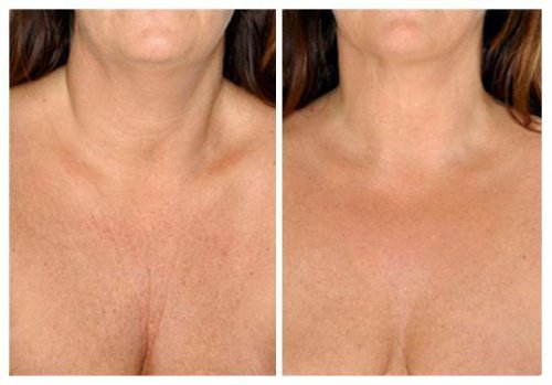 Les meilleurs traitements naturels pour prendre soin de la peau du cou Les meilleurs traitements naturels pour prendre soin de la peau du cou