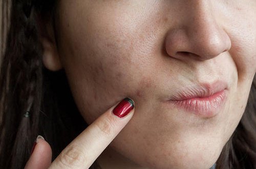 Les 7 erreurs commises dans le soin de la peau