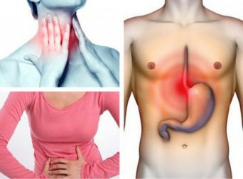 Vous souffrez de reflux gastro-oesophagien sans le savoir ? Découvrez les symptômes et traitements