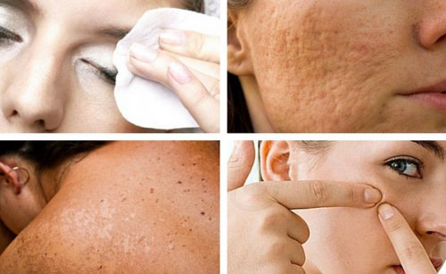 7 habitudes qui nuisent à la santé de votre peau et que vous pouvez éviter