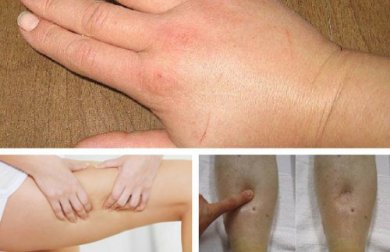 Les 8 diurétiques qui vous aideront à lutter contre la rétention d'eau