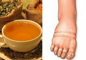 Les 7 meilleures plantes naturelles pour lutter contre la rétention d'eau