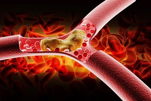 Mauvais-cholesterol-500x334