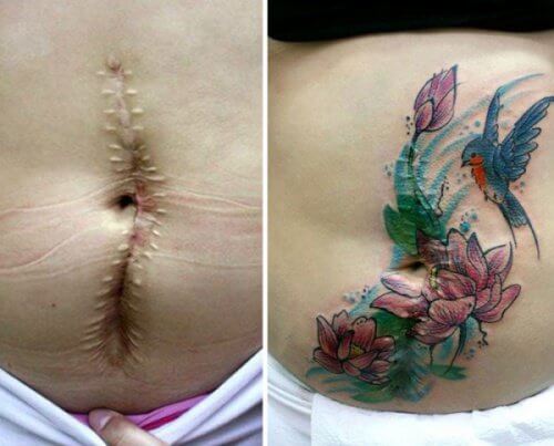Les tatouages pour "effacer" les blessures de la vie