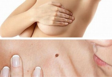 4 auto-examens du cancer à savoir