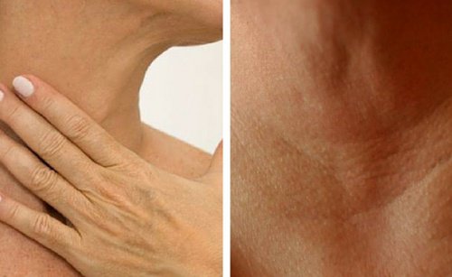 4 traitements naturels pour prévenir l’apparition de rides dans le cou et sur les mains 4 traitements naturels pour prévenir l’apparition de rides dans le cou et sur les mains
