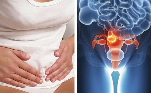 7 signaux de cancer du col de l'utérus dont il faut tenir compte