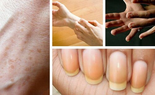 9 choses intéressantes que les mains disent sur notre santé