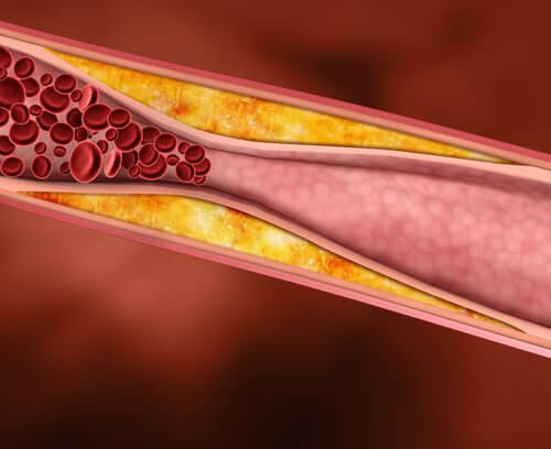 Cholesterol-500x408