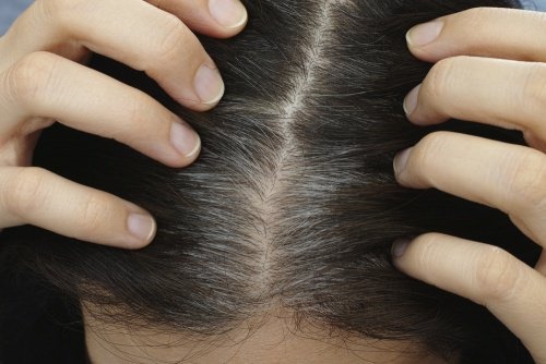 Comment éviter l'apparition de cheveux blancs prématurés ?