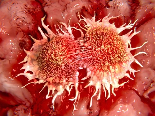 Therapie-anti-cancer-au-citron-congele-500x375