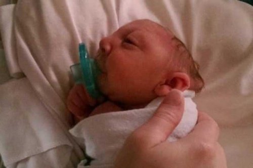 bebe-malformation-500x332