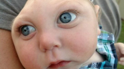 La maladie de Jaxon.