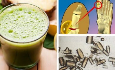 Comment éliminer l'acide urique naturellement ?