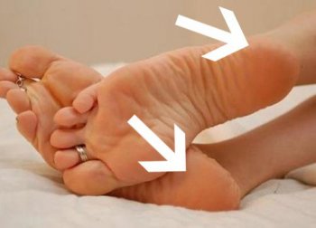 Pourquoi les talons nous démangent-ils ?
