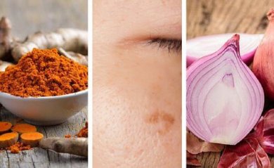 Vous avez des taches sur la peau ? Voici 6 remèdes pour les atténuer