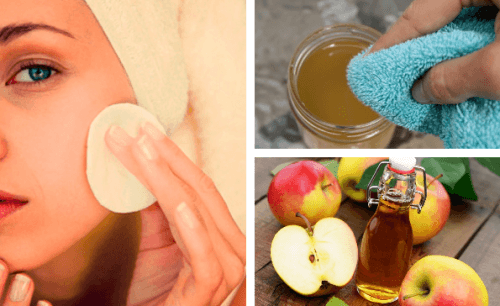 Nettoyer son visage au vinaigre de pomme pendant cinq jours