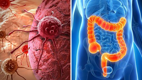 Etude sur la viande transformée.