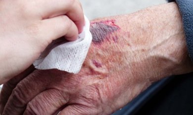 Les erreurs que nous commettons pendant les premiers soins