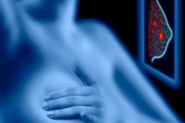 Les risques d'une mammographie sont-ils plus importants que leurs bienfaits ?
