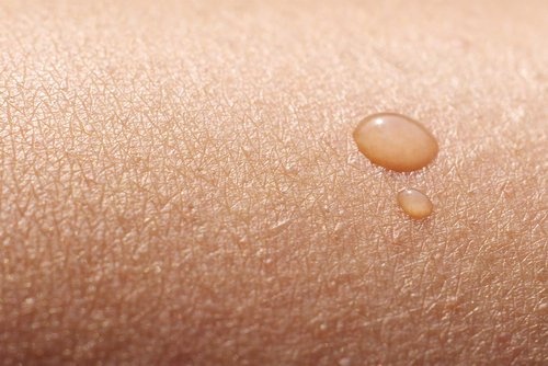 Peau très sèche