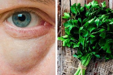 Remède au persil pour les paupières gonflées