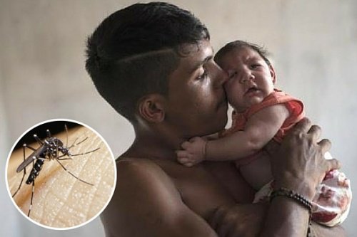 Alerte au virus Zika : les 10 choses qu’il faut savoir Alerte au virus Zika : les 10 choses qu’il faut savoir