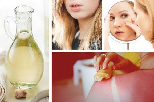 Découvrez 8 utilisations du vinaigre blanc qui vont vous surprendre ! Découvrez 8 utilisations du vinaigre blanc qui vont vous surprendre !