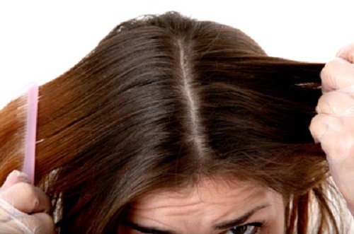 Cheveux-gras-500x331