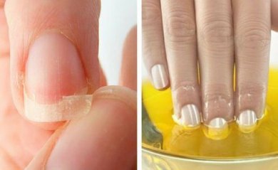 Ongles fragiles ? Essayez ces remèdes naturels !