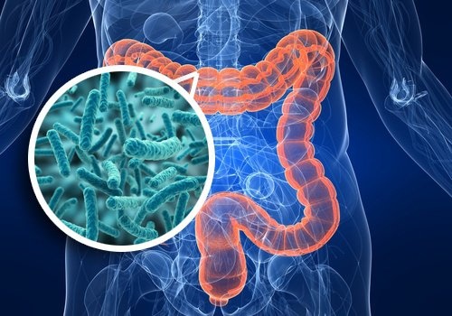 Syndrome de surcharge bactérienne dans l'intestin : symptômes et alimentation