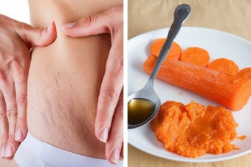 Remède à la carotte contre les vergetures